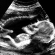 Image for article titled Royal Family Releases Kate Middleton Ultrasound Image